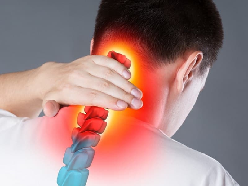 درمان گردن درد عصبی